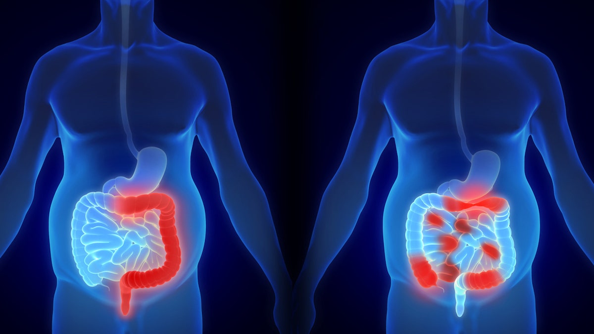 IBD diagram