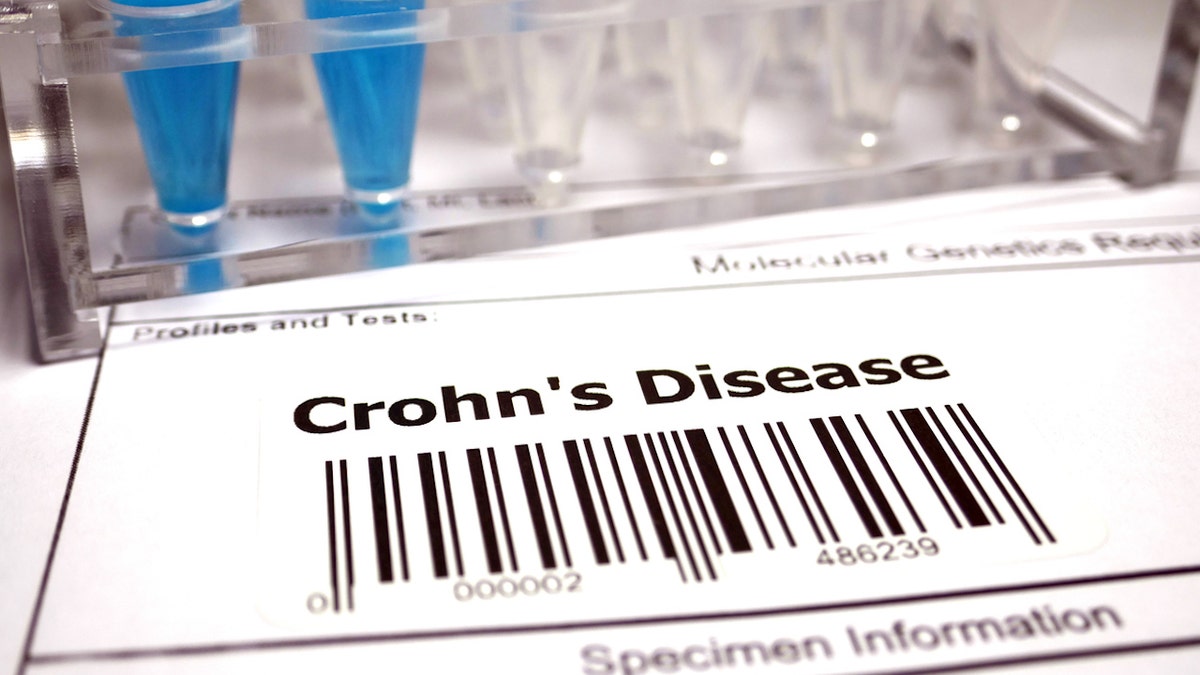 Crohn's disease